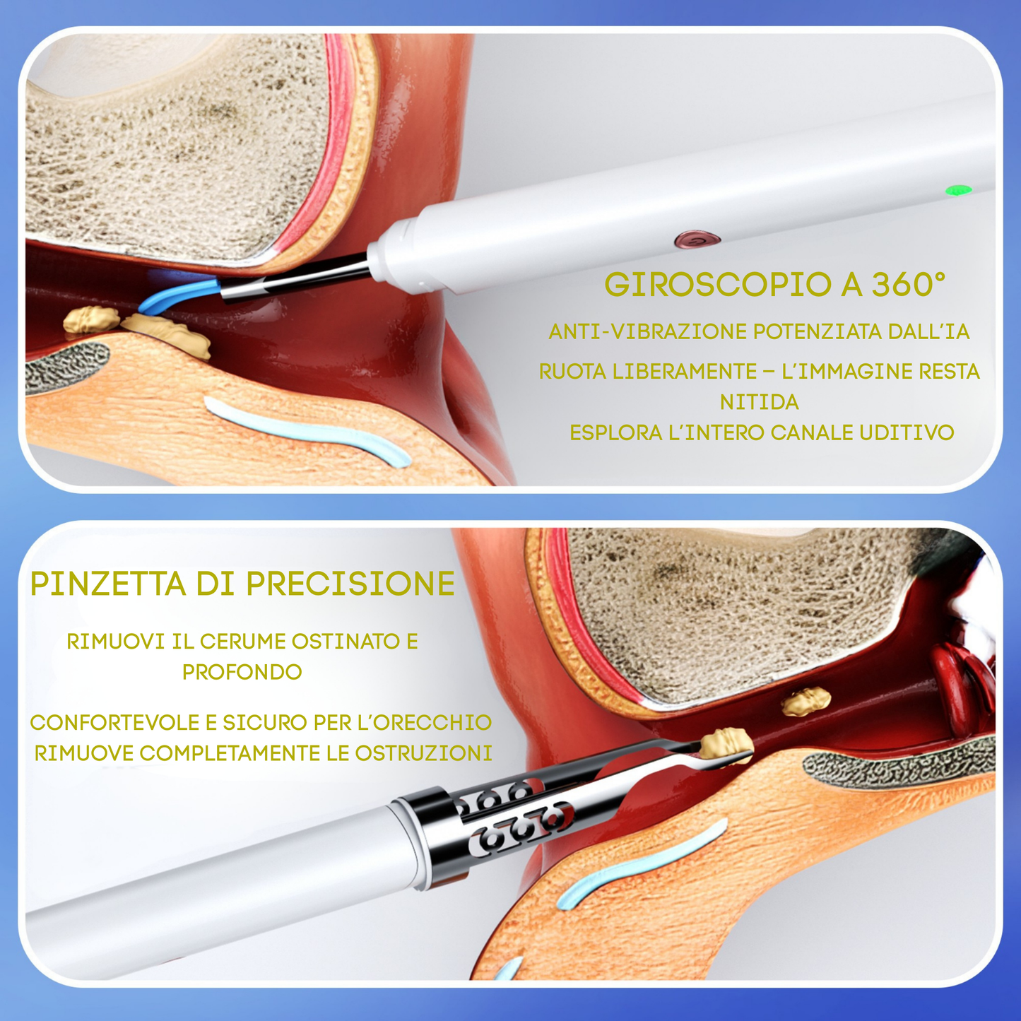 Calynia™:Dispositivo con visione HD per la pulizia delle orecchie